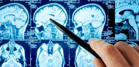 Os principais problemas neurológicos que levam os pacientes a procurarem um neurologista!