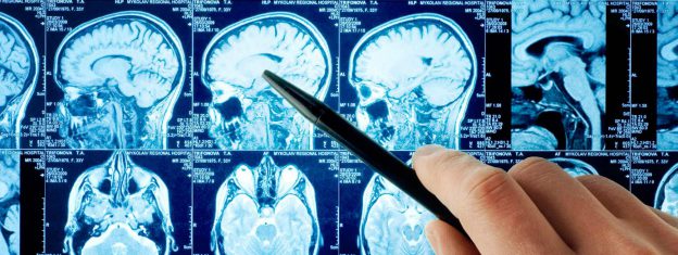 Os principais problemas neurológicos que levam os pacientes a procurarem um neurologista!